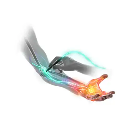Illustration of a Stimpod therapy probe applied near the elbow and forearm